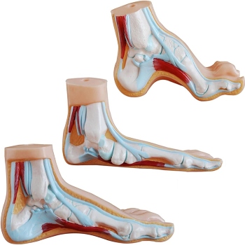 Normal, Flat and Arched Foot